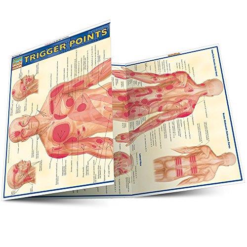 9781423203162: Trigger Points (Quick Study Academic)