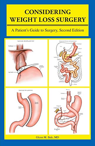 Imagen de archivo de Considering Weight Loss Surgery: A Patient's Guide to Surgery, Second Edition a la venta por Half Price Books Inc.