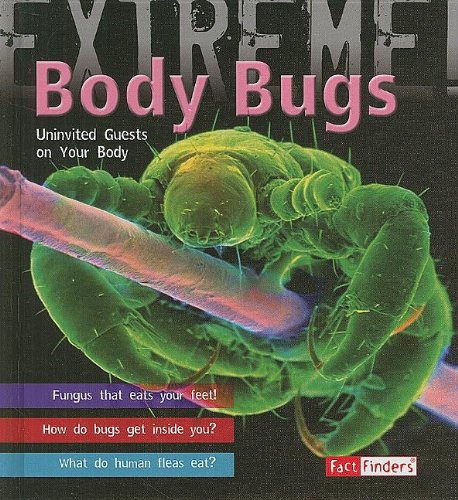 9781429631129: Body Bugs!: The Uninvited Guests on Your Body (Fact Finders; Extreme)