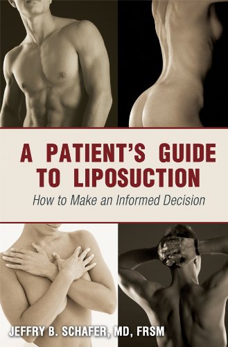 9781432781477: A Patient's Guide to Liposuction: How to Make an Informed Decision