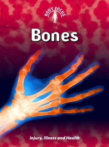 9781432934163: Bones: Injury, Illness, and Health (Body Focus)