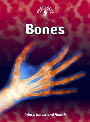 9781432934293: Bones: Injury, Illness, and Health (Body Focus)