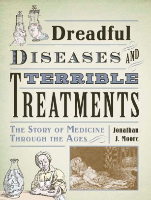 Beispielbild fr Dreadful Diseases and Terrible Treatments : The Story of Medicine Through the Ages zum Verkauf von Better World Books
