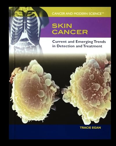 9781435837447: Skin Cancer: Current and Emerging Trends in Detection and Treatment (Cancer and Modern Science)