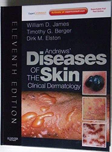Stock image for Andrews' Diseases of the Skin : Clinical Dermatology for sale by Better World Books