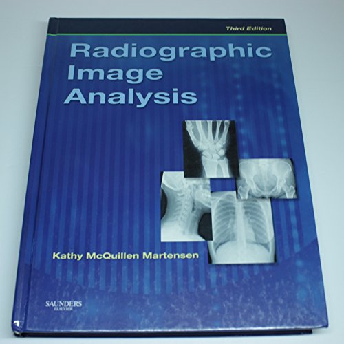 Beispielbild fr Radiographic Image Analysis zum Verkauf von SecondSale