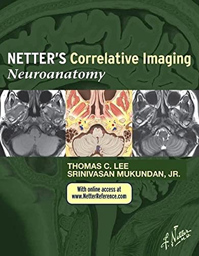 9781437704150: Netter's Correlative Imaging: Neuroanatomy: with NetterReference.com Access (Netter Clinical Science)