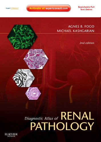 9781437704273: Diagnostic Atlas of Renal Pathology: Expert Consult - Online and Print