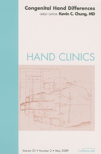 Stock image for Congenital Hand Differences, an Issue of Hand Clinics: Volume 25-2 for sale by ThriftBooks-Atlanta