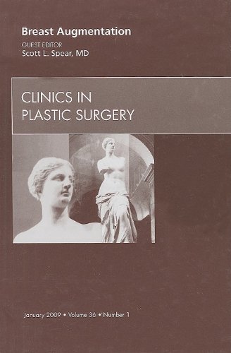 Stock image for Breast Augmentation, An Issue of Clinics in Plastic Surgery, 1e (The Clinics: Surgery) for sale by Chiron Media