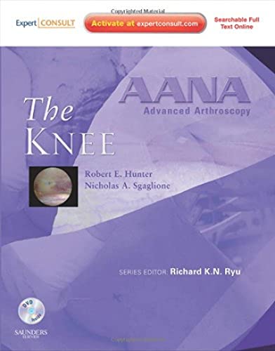 9781437706642: AANA Advanced Arthroscopy: The Knee: Expert Consult: Online, Print and DVD