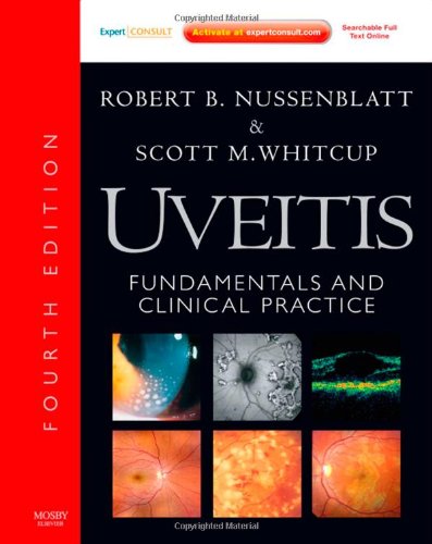 9781437706673: Uveitis: Fundamentals and Clinical Practice: Expert Consult - Online and Print, 4e