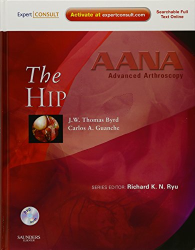 Stock image for AANA Advanced Arthroscopy: The Hip: Expert Consult: Online, Print and DVD for sale by ThriftBooks-Dallas