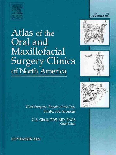 Stock image for Cleft Surgery: Repair of the Lip, Palate, and Alveolus, an Issue of Atlas of the Oral and Maxillofacial Surgery Clinics: Volume 17-2 for sale by ThriftBooks-Atlanta