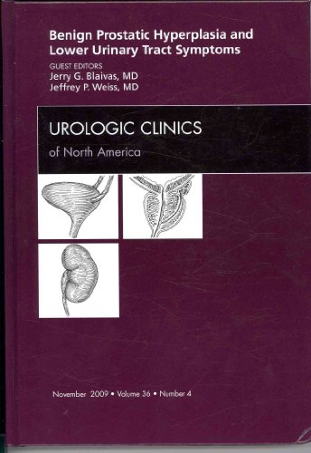 9781437712797: Benign Prostatic Hyperplasia and Lower Urinary Tract Symptoms, An Issue of Urologic Clinics (Volume 36-4) (The Clinics: Internal Medicine, Volume 36-4)
