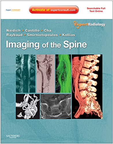 Imaging of the Spine: Expert Radiology Series, Expert Consult-Online and Print (9781437715514) by Thomas P. Naidich; Mauricio Castillo; Soonmee Cha; Charles Raybaud; James G. Smirniotopoulos; Spyros Kollias; George M Kleinman