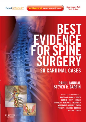 Beispielbild fr Best Evidence for Spine Surgery: 20 Cardinal Cases, Expert Consult - Online and Print zum Verkauf von Revaluation Books