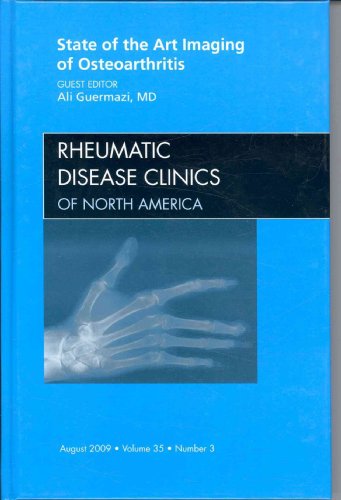 Beispielbild fr State of The Art Imaging of Osteoarthritis, An Issue of Rheumatic Disease Clinics, 1e zum Verkauf von Hamelyn