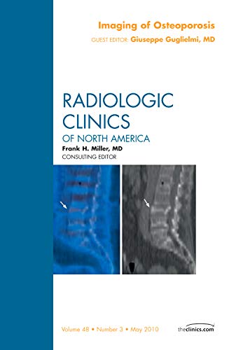 Imagen de archivo de IMAGING OF OSTEOPOROSIS RADIOLOGIC CLINICS OF NORTH AMERICA a la venta por AG Library