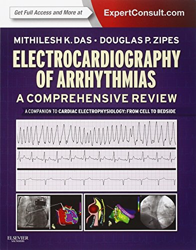 Imagen de archivo de Electrocardiography of Arrhythmias: A Comprehensive Review: A Companion to Cardiac Electrophysiology a la venta por Books Unplugged