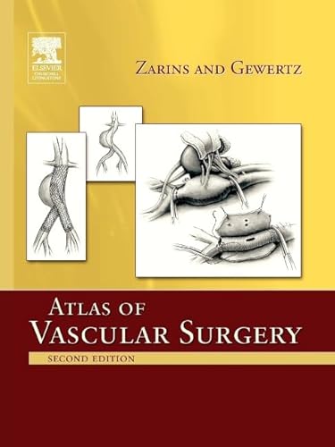Stock image for Atlas of Vascular Surgery - Paperback Edition for sale by HPB-Red