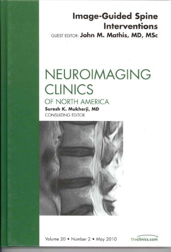 Stock image for Image-Guided Spine Interventions, An Issue of Neuroimaging Clinics (The Clinics: Radiology): Volume 20-2 for sale by Chiron Media