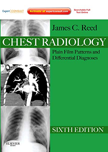 Beispielbild fr Chest Radiology: Plain Film Patterns and Differential Diagnoses, Expert Consult - Online and Print (Expert Consult Title: Online + Print) zum Verkauf von HPB-Red