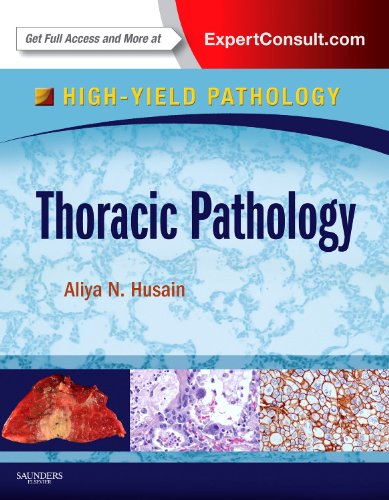 9781437723809: Thoracic Pathology: A Volume in the High Yield Pathology Series (Expert Consult - Online and Print)