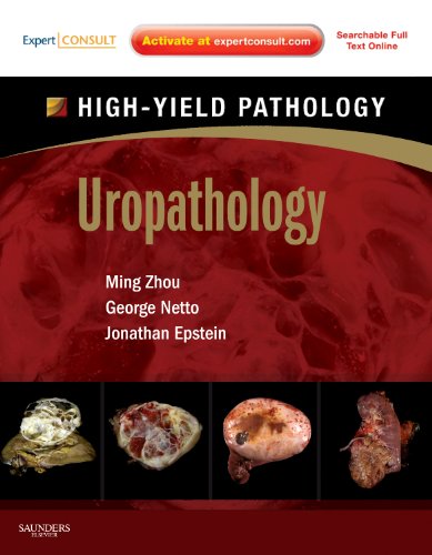 Stock image for Uropathology: A Volume in the High Yield Pathology Series (Expert Consult - Online and Print) for sale by HPB-Red