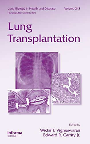 Beispielbild fr Lung Transplantation: 243 (Lung Biology in Health and Disease) zum Verkauf von Reuseabook