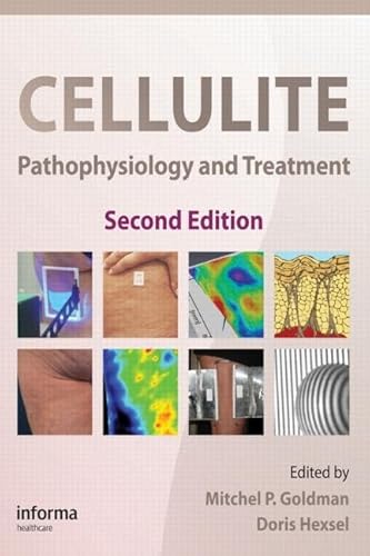 9781439802717: Cellulite: Pathophysiology and Treatment: 1 (Basic and Clinical Dermatology)