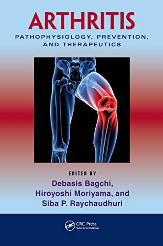 Imagen de archivo de Arthritis: Pathophysiology, Prevention, and Therapeutics a la venta por Buchpark