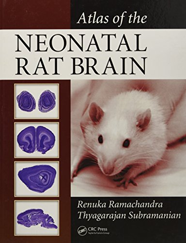 Beispielbild fr Atlas of the Neonatal Rat Brain zum Verkauf von medimops