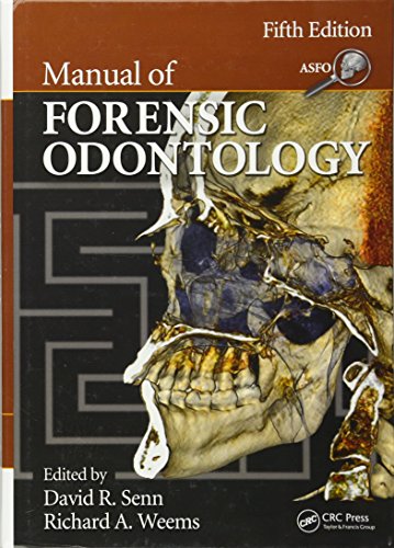 9781439851333: MANUAL OF FORENSIC ODONTOLOGY