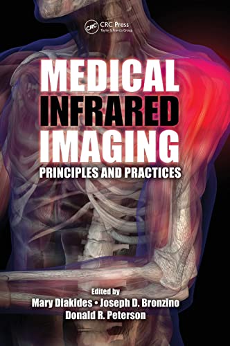 Stock image for Medical Infrared Imaging: Principles and Practices for sale by Mispah books