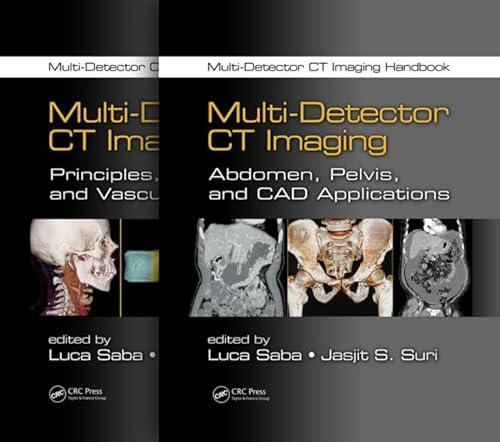 9781439893999: Multi-Detector CT Imaging Handbook, Two Volume Set