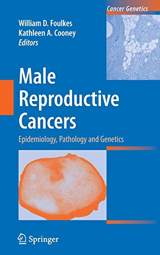 Stock image for Male Reproductive Cancers : Epidemiology, Pathology and Genetics for sale by Better World Books