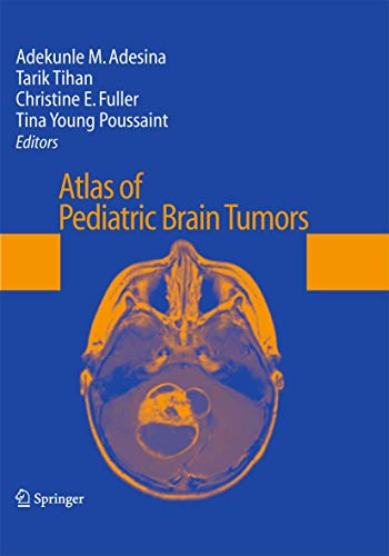 Stock image for Atlas of Pediatric Brain Tumors. for sale by Antiquariat im Hufelandhaus GmbH  vormals Lange & Springer