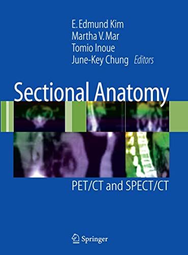 Imagen de archivo de Sectional Anatomy: PET/CT and SPECT/CT a la venta por BooksRun