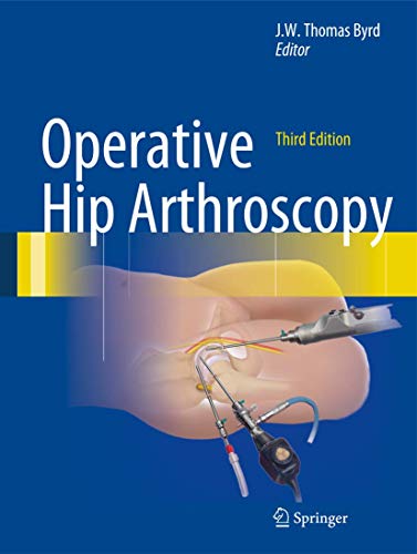 Stock image for Operative Hip Arthroscopy for sale by Better World Books Ltd
