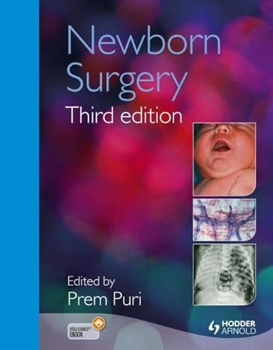 9781444102833: Newborn Surgery 3E