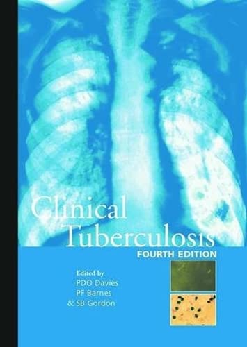 9781444109641: Clinical Tuberculosis