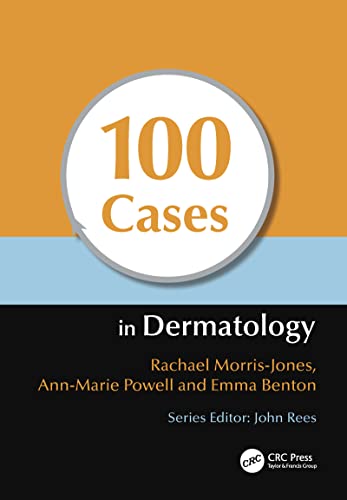Beispielbild fr 100 Cases in Dermatology zum Verkauf von Better World Books