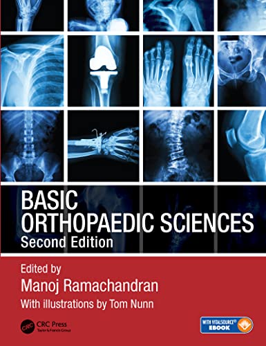 9781444120981: Basic Orthopaedic Sciences