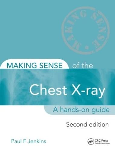 Stock image for Making Sense of the Chest X-Ray for sale by Blackwell's