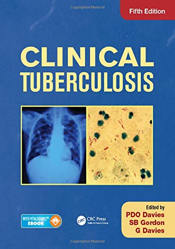 Imagen de archivo de Clinical Tuberculosis a la venta por Mispah books