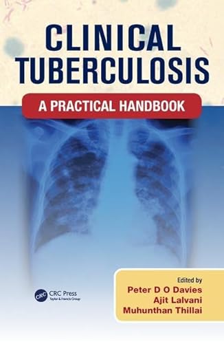 Clinical Tuberculosis: A Practical Handbook (9781444163209) by Davies, Peter D. O.