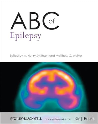 Stock image for ABC of Epilepsy for sale by Better World Books