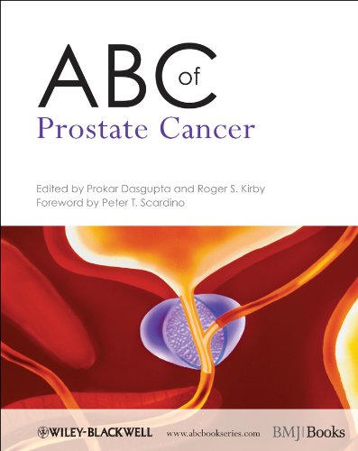 Stock image for ABC of Prostate Cancer for sale by ThriftBooks-Atlanta