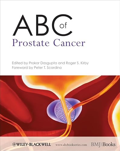 ABC of Prostate Cancer (9781444334371) by Dasgupta, Prokar; Kirby, Roger S.